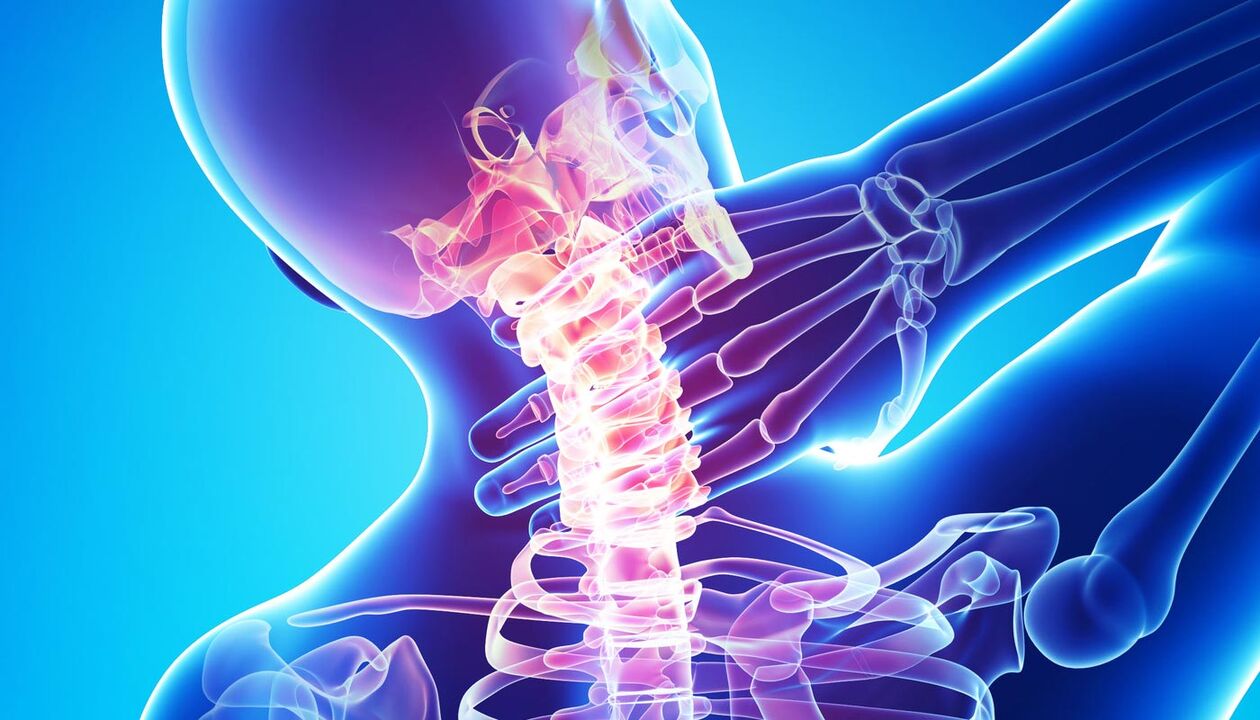 болка във врата поради остеохондроза